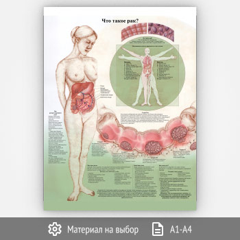 ������ ���� ����� ���?� (���-19, 1 ����)