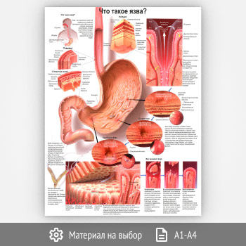 ������ ���� ����� ����?� (���-35, 1 ����)